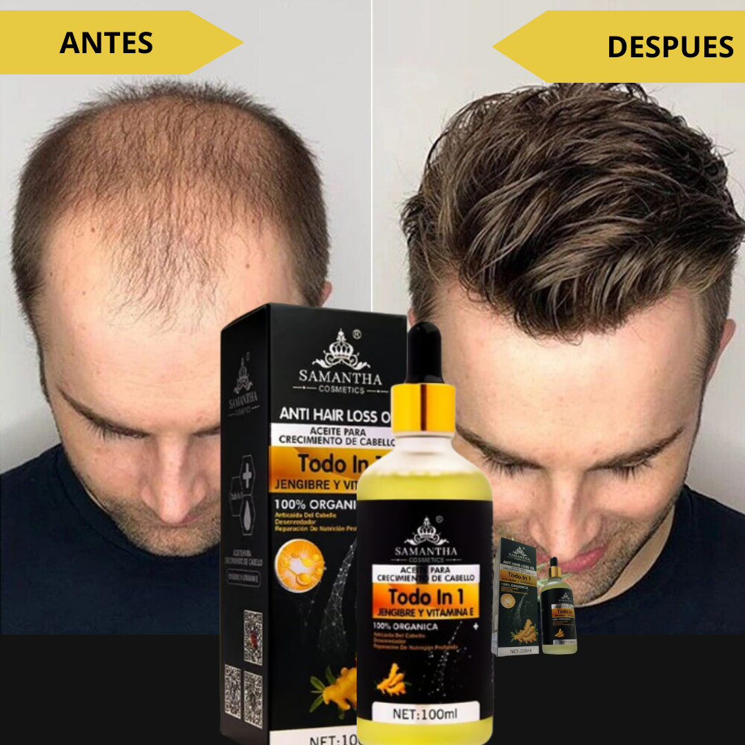 NUEVO SERUM ANTI PÉRDIDA DE CABELLO